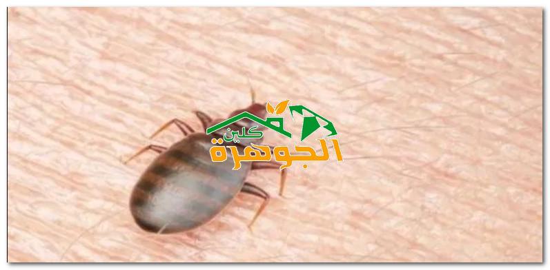شركات مكافحة بق الفراش بالاحساء